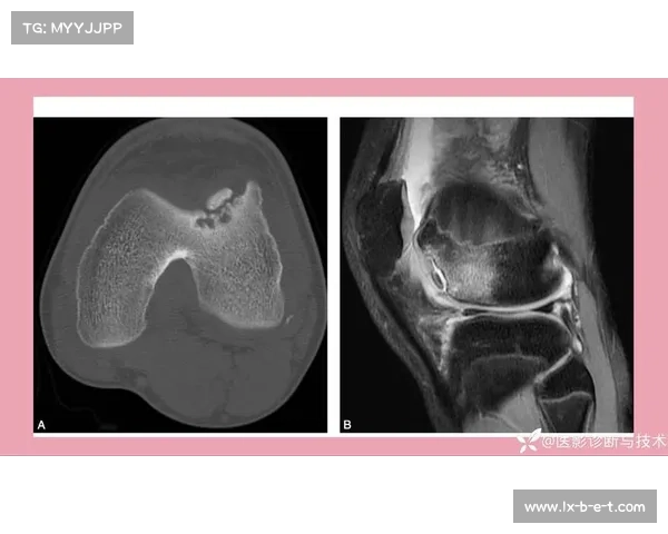 战觉城医疗协议更新：所有青少年赛事强制进行脑部MRI检查保障安全